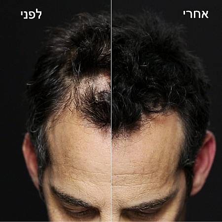 טופיק לשיער צבע פלטין - 12 גרם - מבית Toppik