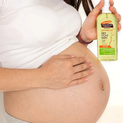 פאלמרס שמן לגוף להרגעה והזנה לעור יבש ומגרד עם חמאת קקאו ויטמין E נפח 150 מ"ל - Palmer's