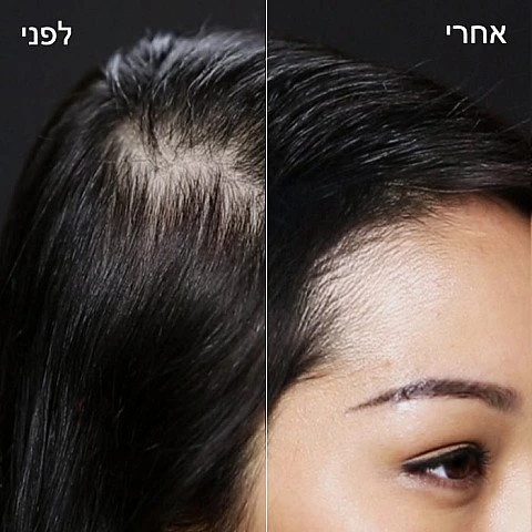 טופיק לשיער צבע חום - 12 גרם - מבית Toppik